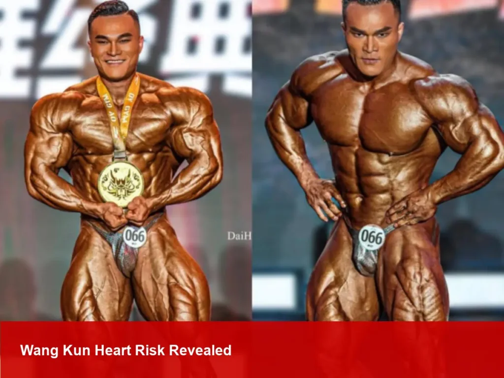 Wang Kun, Chinese Bodybuilder, Dies at 30 — Heart Attack