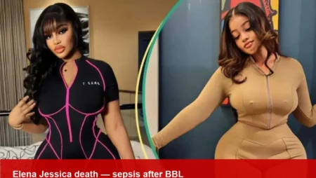 Elena Jessica, TikTok influencer, dies after BBL surgery
